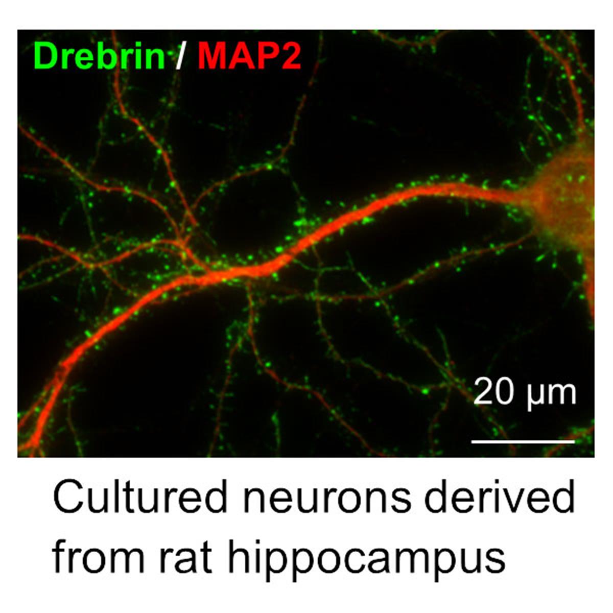 /Content/Upload/Product/FNK-AAB002-Drebrin-antibody-M2F6-Shirao-Mouse-mAb-Diagnocine_1200.jpg