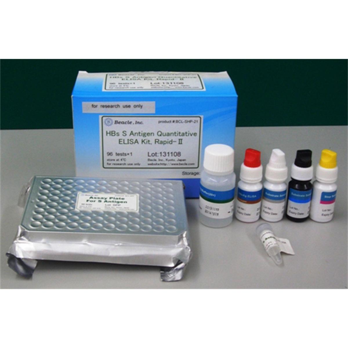 /Content/Upload/Product/FNK-BCL-SHP-21_HB-S-Antigen-Quantitative-ELISA-Kit_Diagnocine_1200.jpg