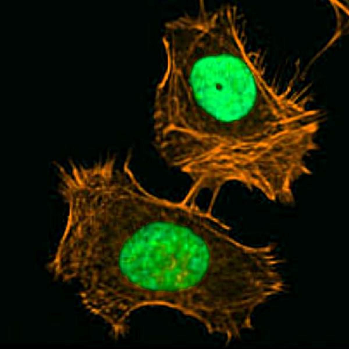 /Content/Upload/Product/FSDFluor594Phalloidin_diagnocine_1200.jpg