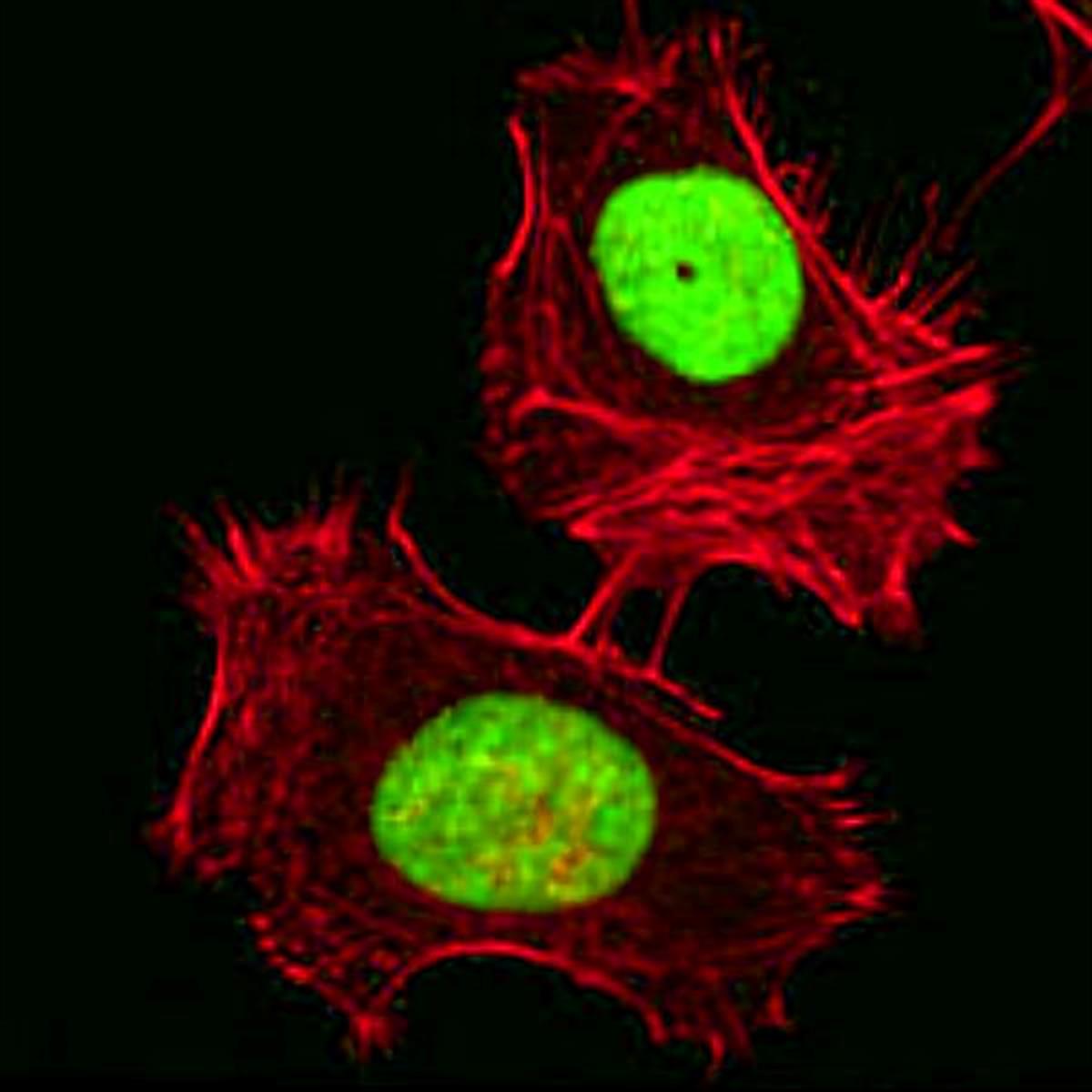 /Content/Upload/Product/FSDFluor647Phalloidin_diagnocine_1200.jpg
