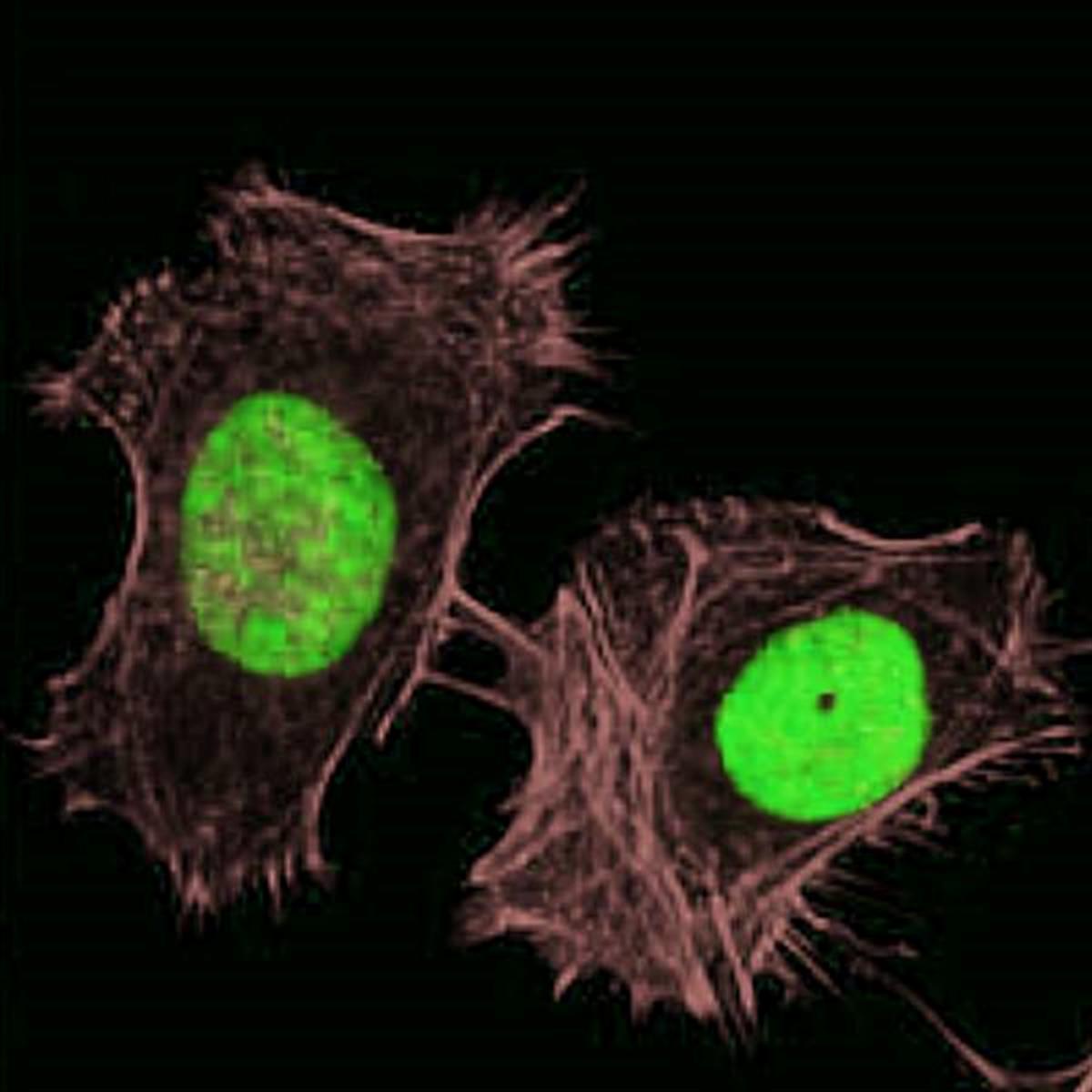 /Content/Upload/Product/FSDFluor750Phalloidin_diagnocine_1200.jpg
