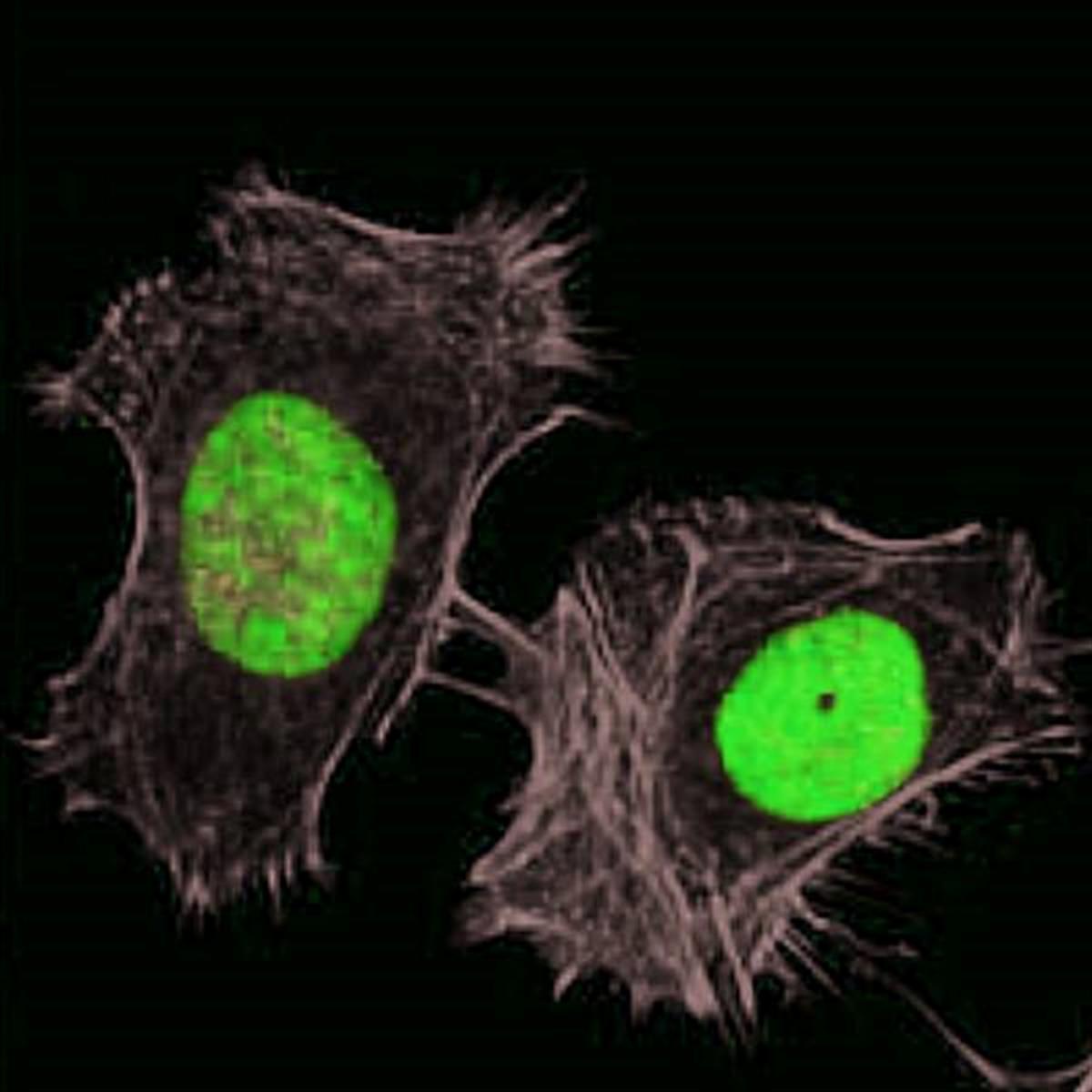 /Content/Upload/Product/FSDFluor800Phalloidin_diagnocine_1200.jpg