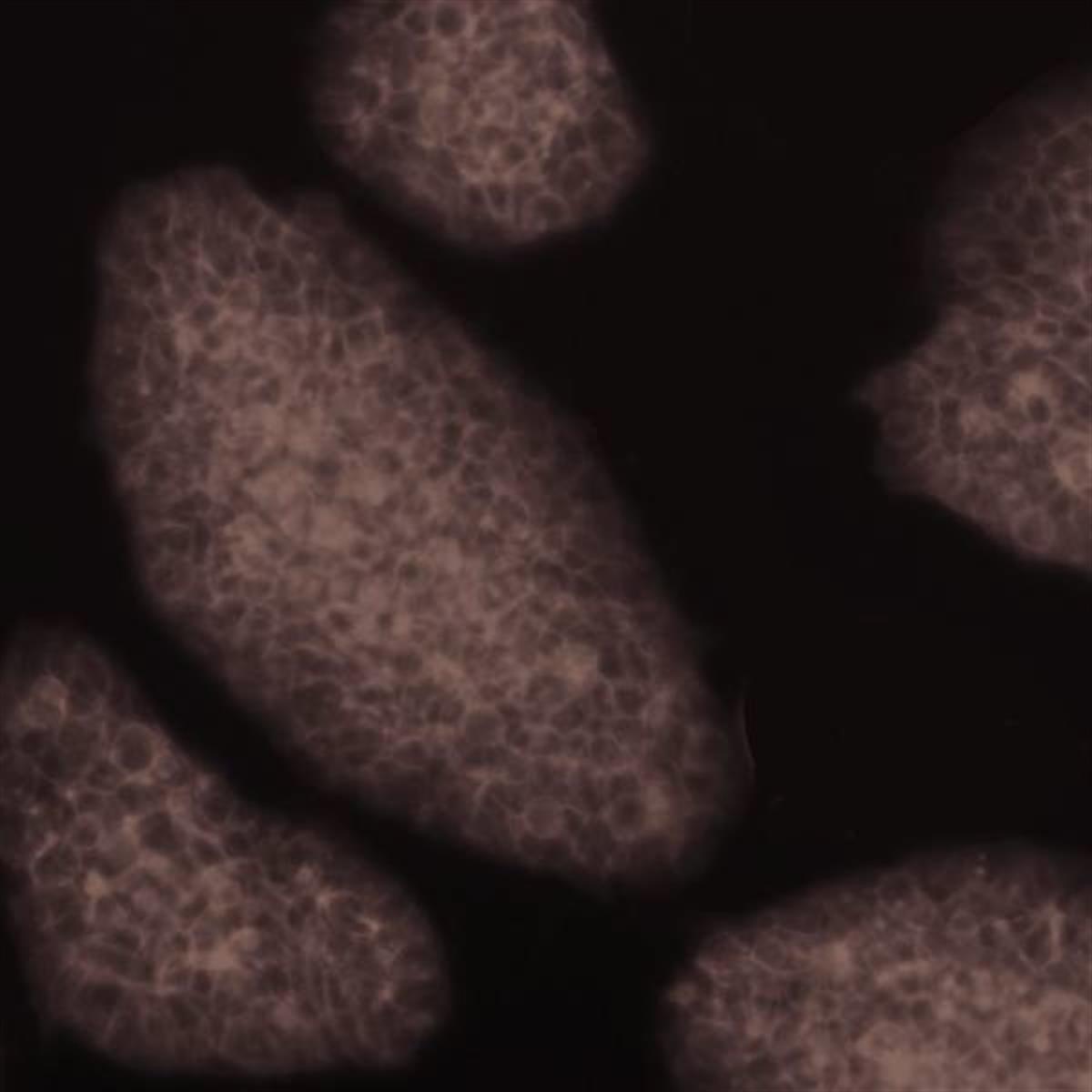 /Content/Upload/Product/Flamma749Dichlorotriazine_diagnocine_1200.jpg