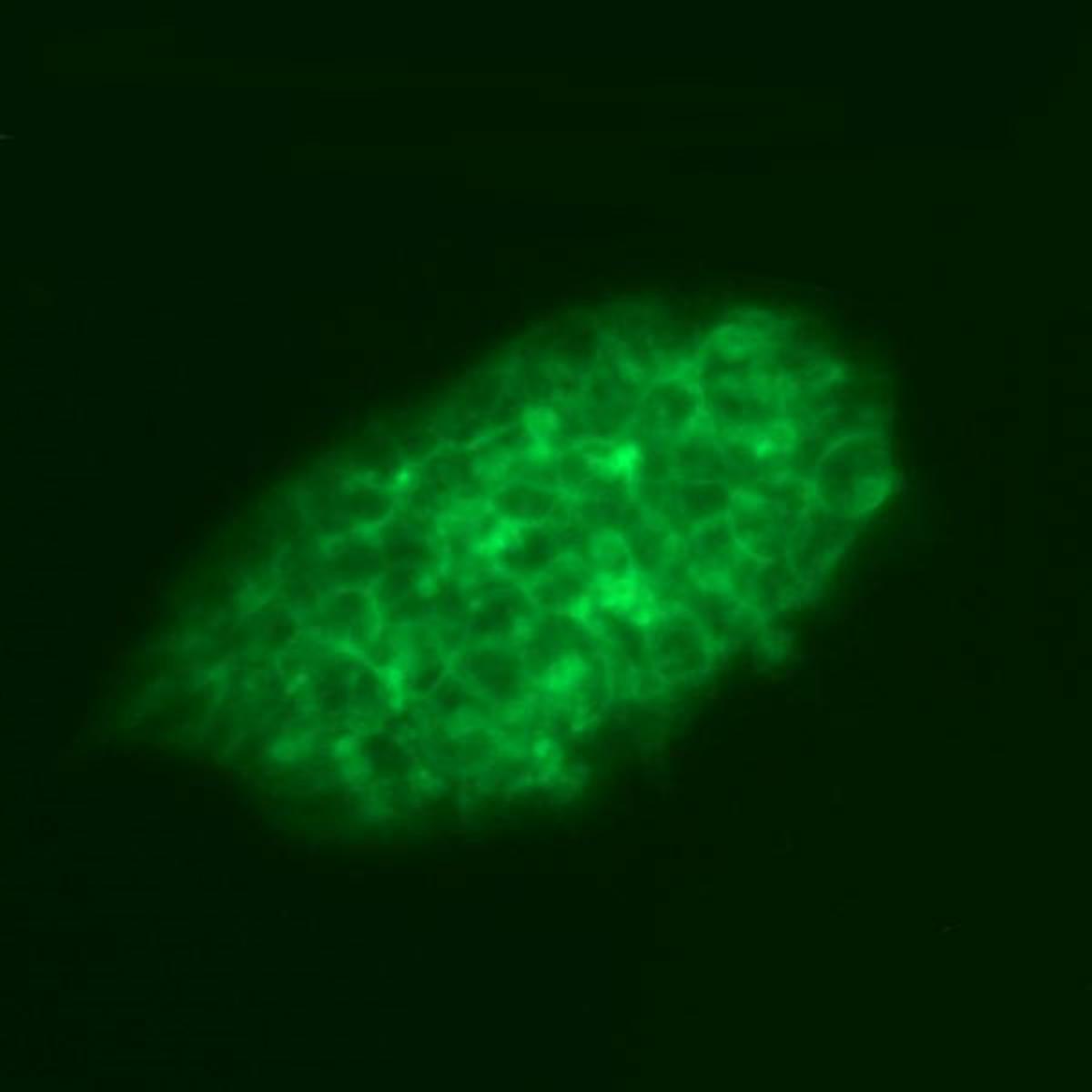 /Content/Upload/Product/HEXNANHSester_diagnocine_1200.jpg