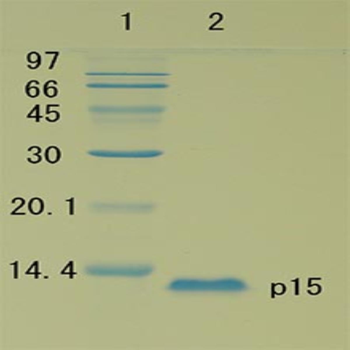 /Content/Upload/Product/HIV1-p15-Proteins-and-Peptides-ab127887-1_1200.jpg