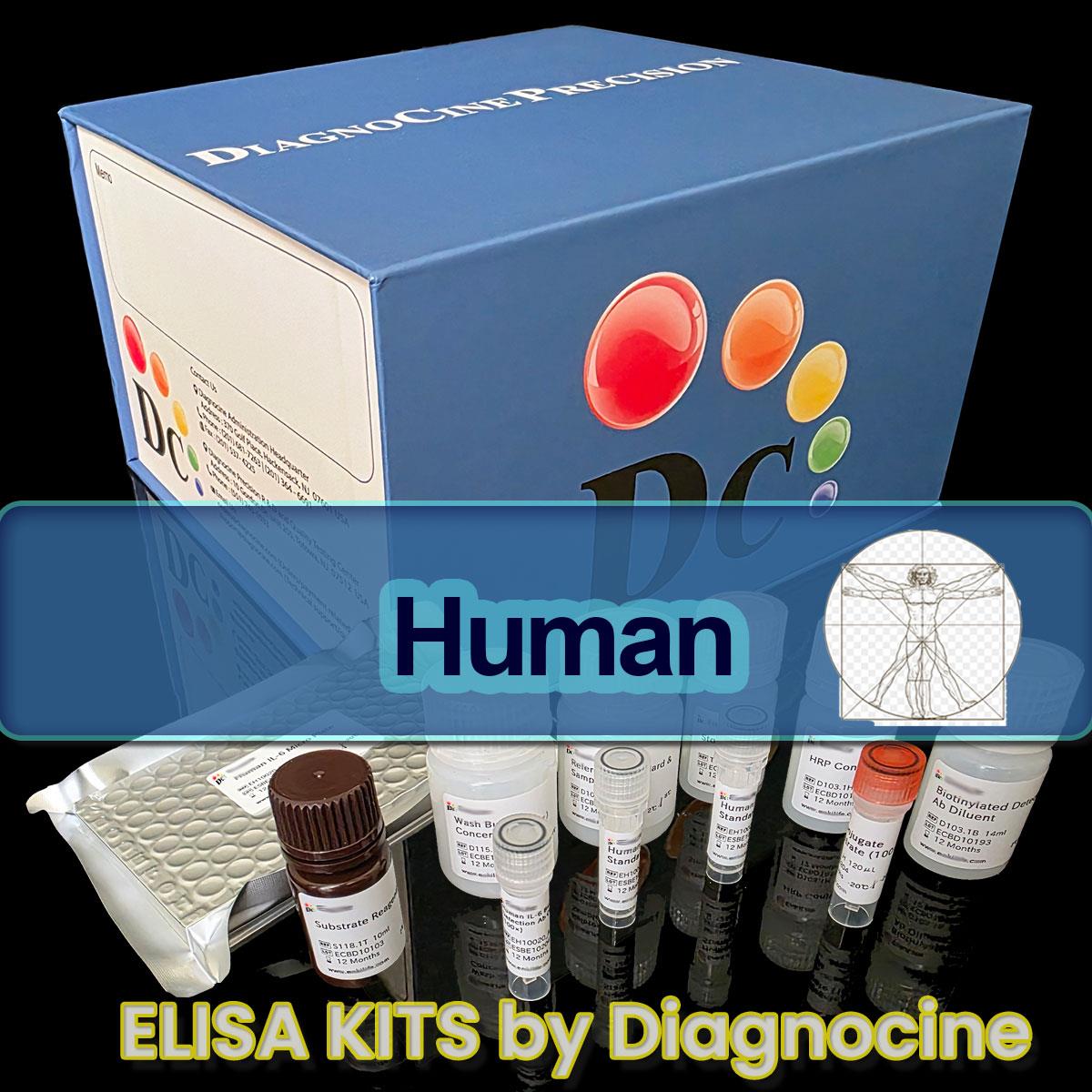 /Content/Upload/Product/Human_ELISA_kits_Diagnocine_1200(23995).jpg