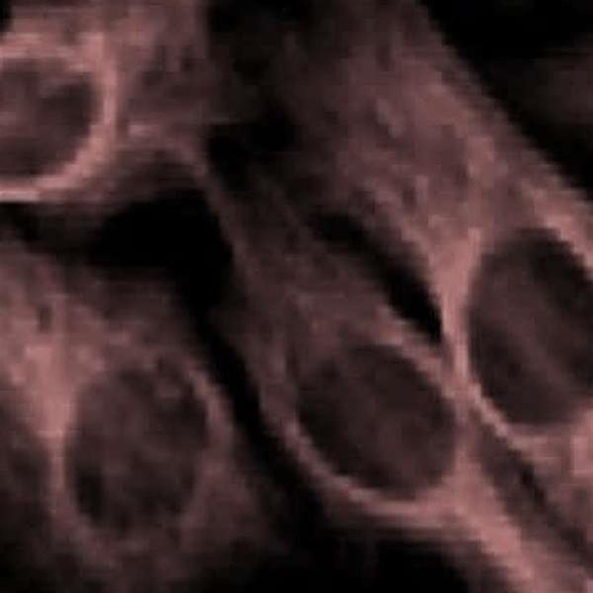 /Content/Upload/Product/ICG_1200.jpg