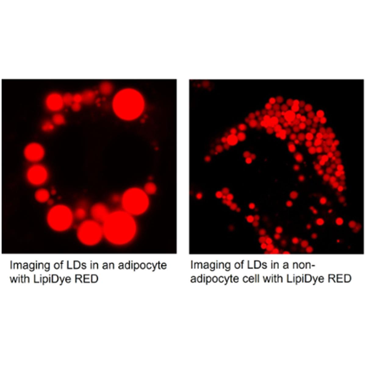 /Content/Upload/Product/LipiDye-RED_FNK-FDV-0057_Diagnocine_1200_1.jpg