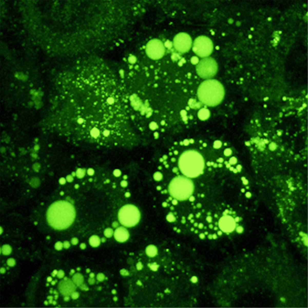 /Content/Upload/Product/LipiDye_600x600_Diagnocine_1200_1200.png
