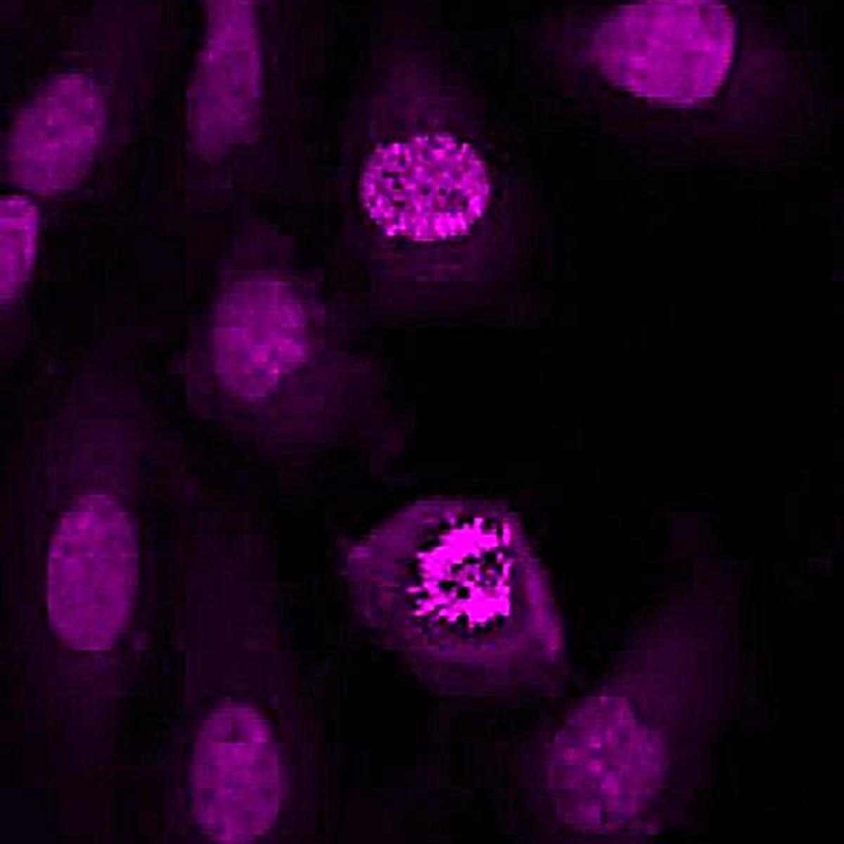 /Content/Upload/Product/NpFlammaROS380_diagnocine_1200.jpg
