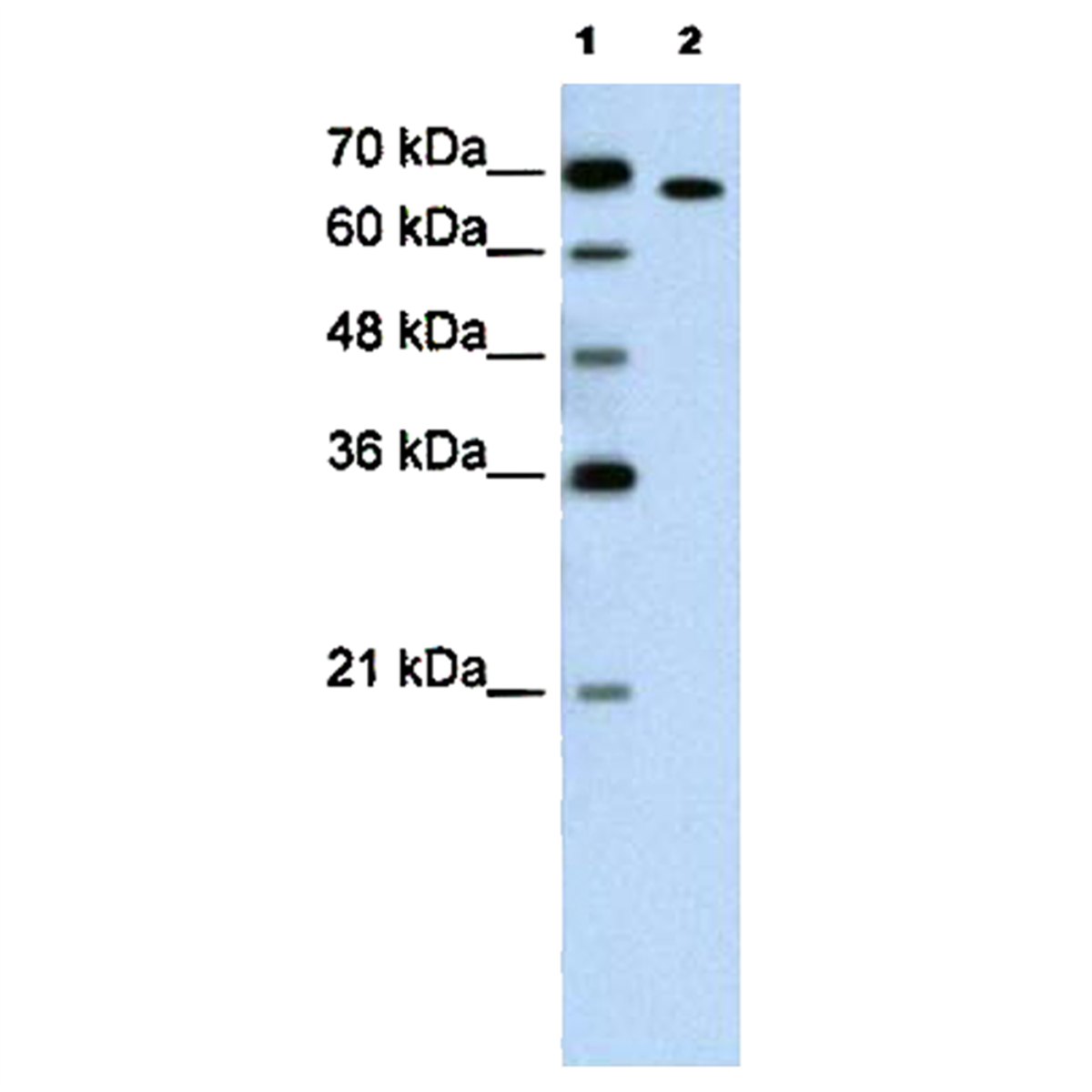 /Content/Upload/Product/PP-H3910-00_fig1_1200.png