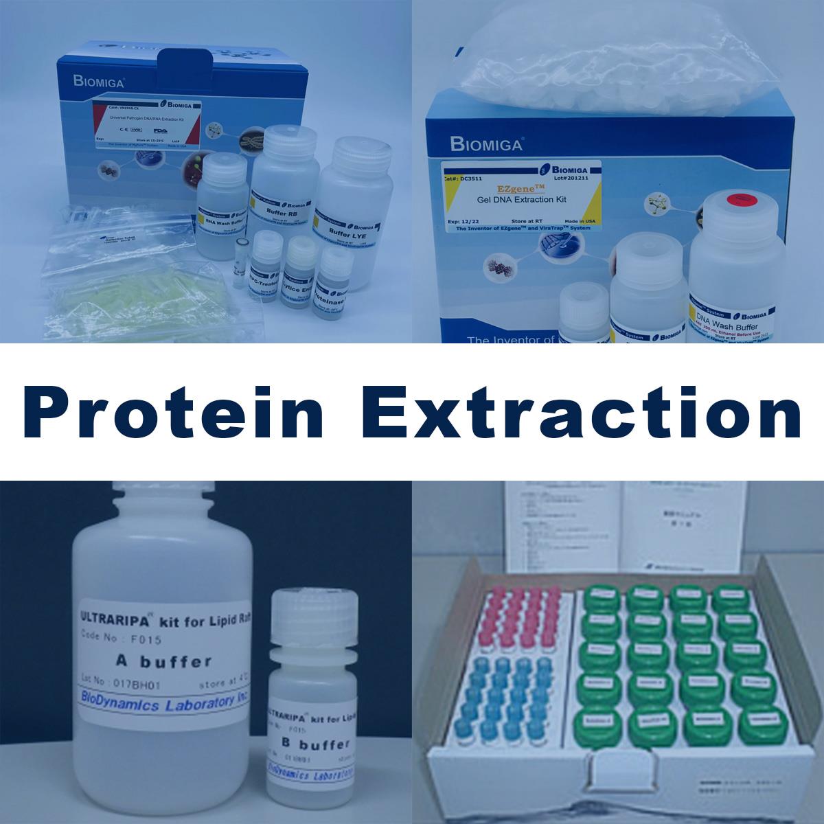 /Content/Upload/Product/Protein_Extraction_Diagnocine_1200.jpg