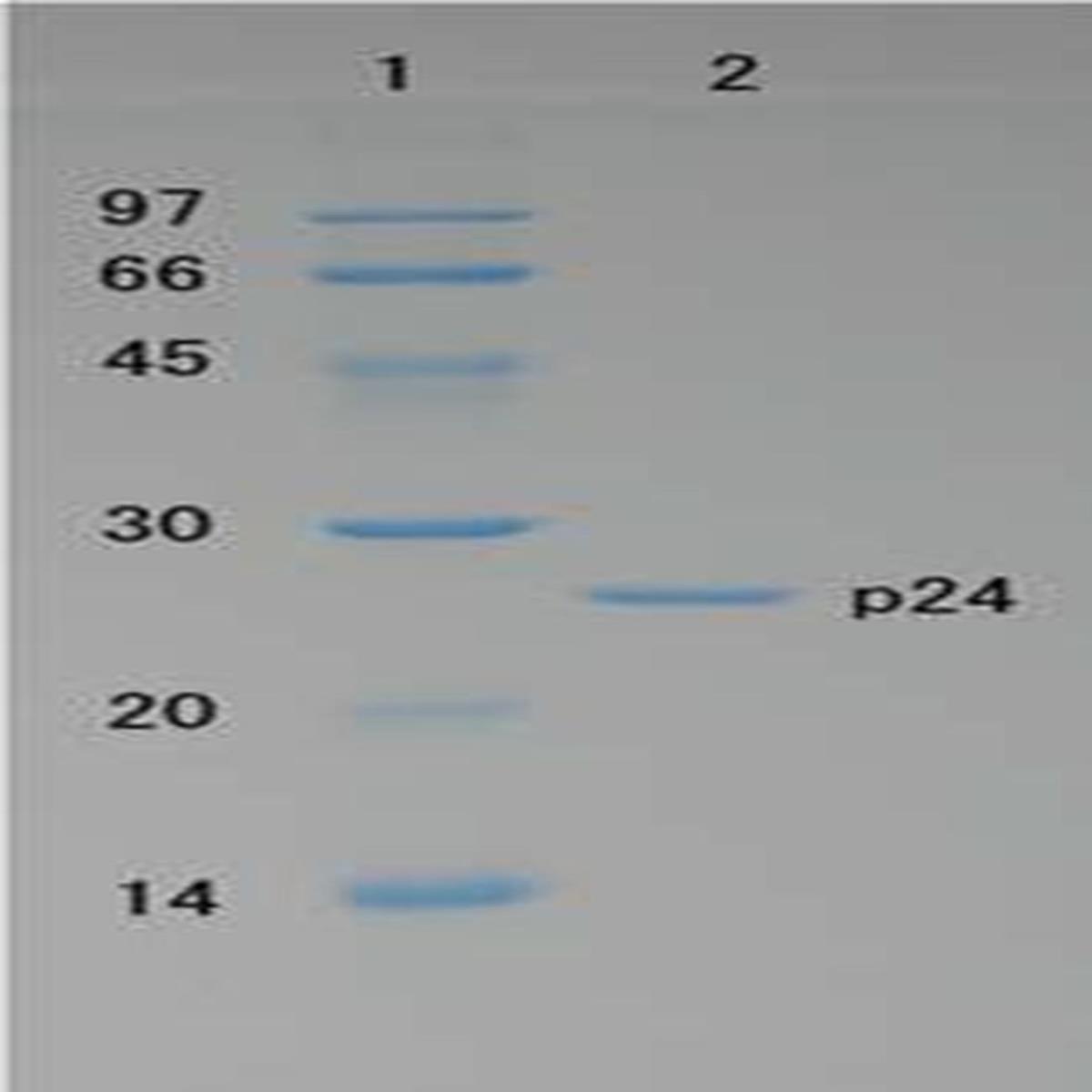 /Content/Upload/Product/RP4917-HIV-1-p24-WB_20181031102015_1200_2.jpg