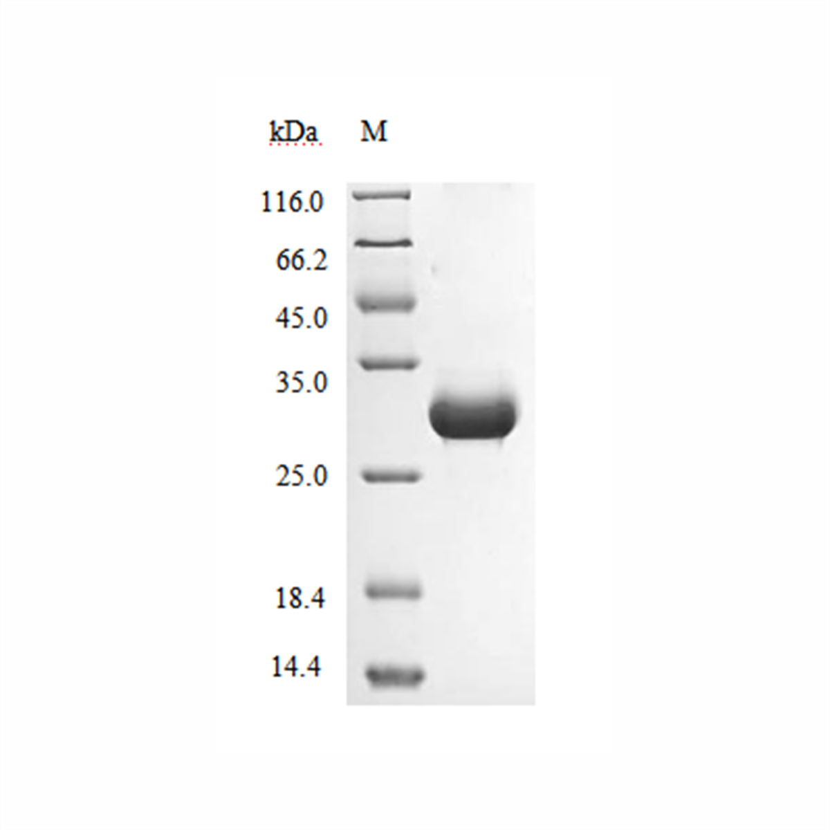 /Content/Upload/Product/Recombinant_Tritirachium_album_Proteinase_K_1200.png