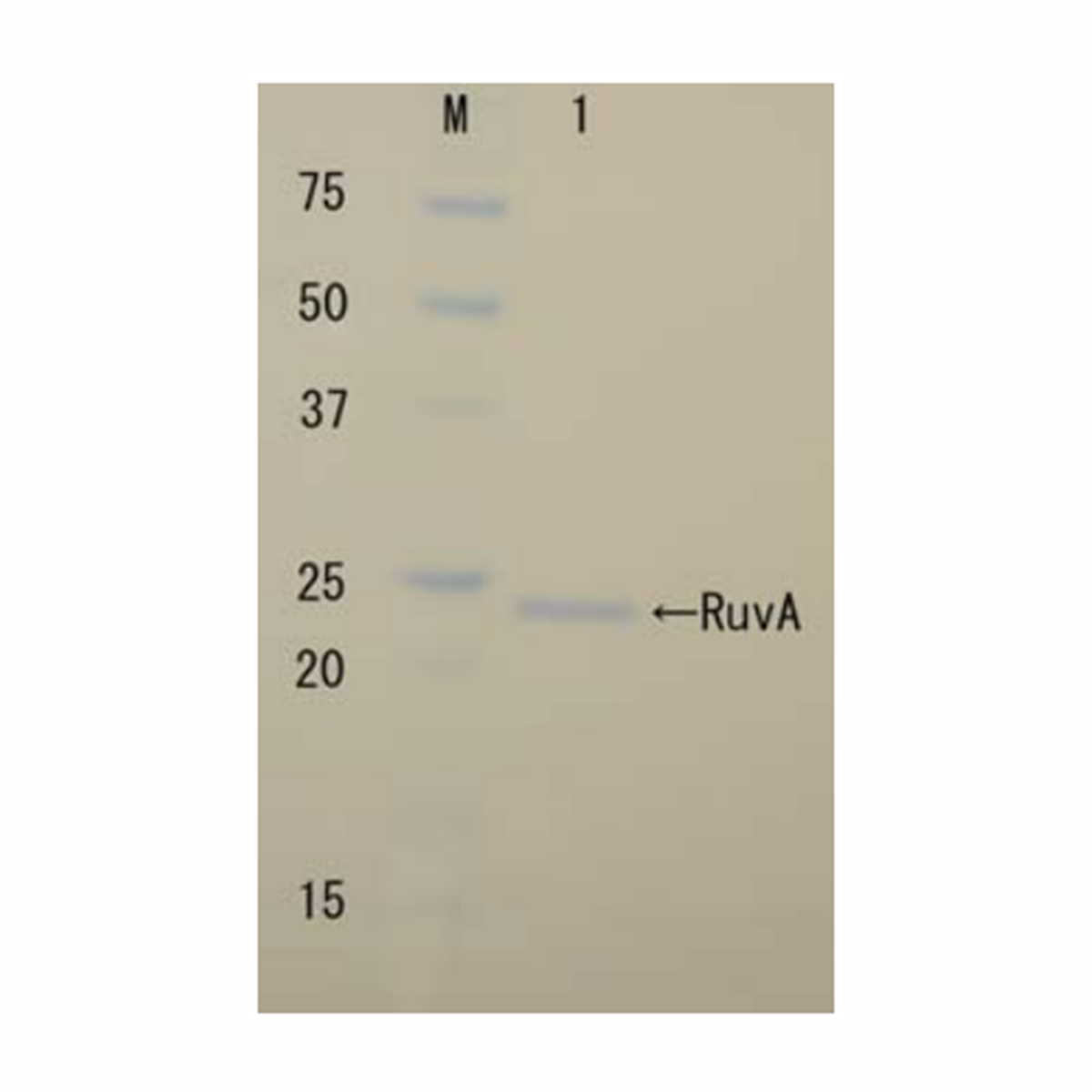 /Content/Upload/Product/RuvA_Recombinant-1_1200.png