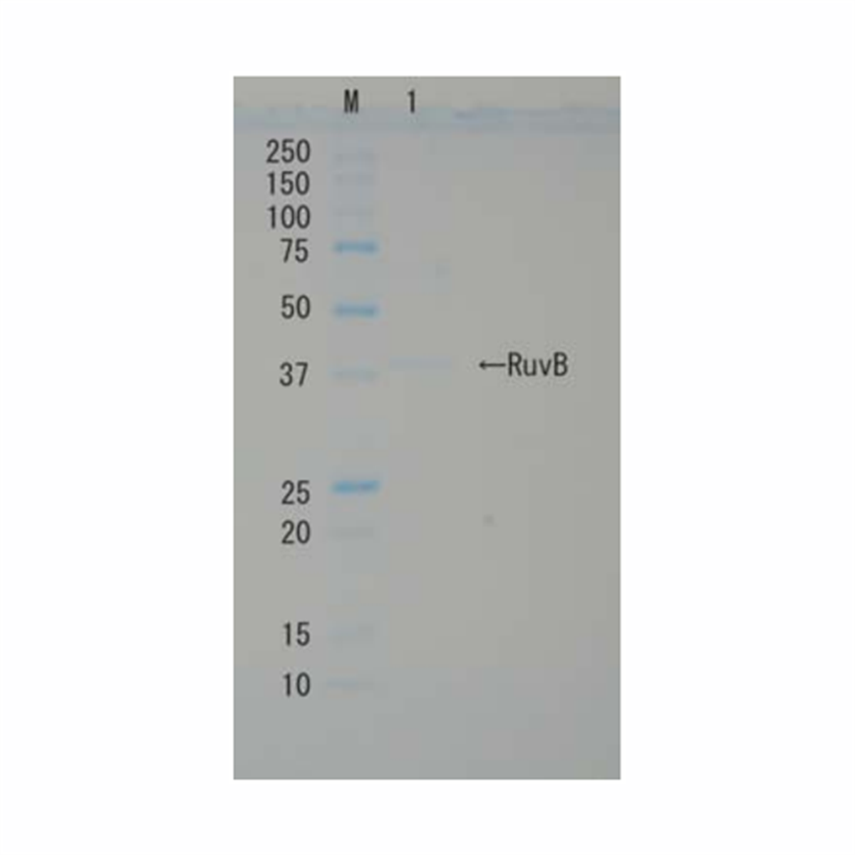 /Content/Upload/Product/RuvB_Recombinant-1_1200_1.png