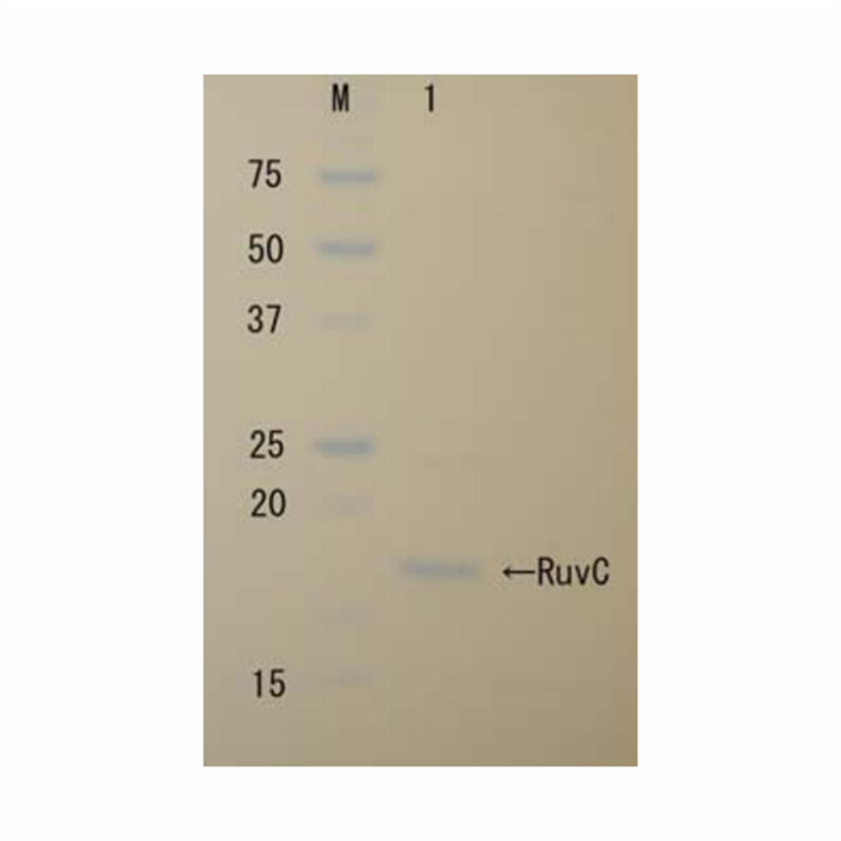 /Content/Upload/Product/RuvC_Recombinant-1_1200_1.png