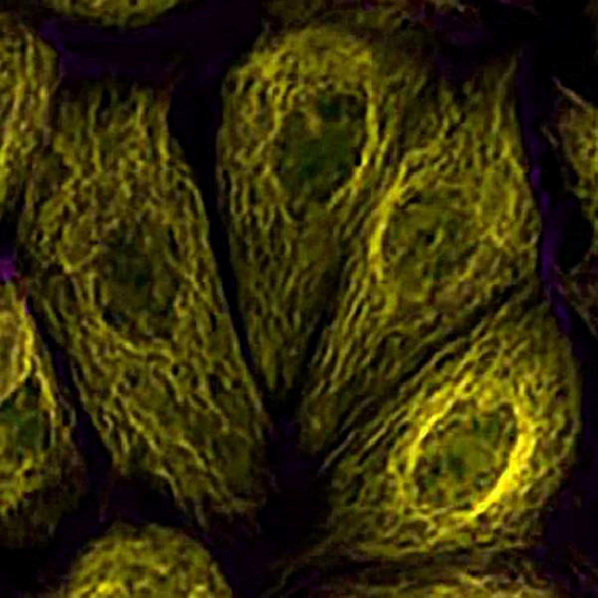 /Content/Upload/Product/TAMRAAzide_diagnocine_1200.jpg