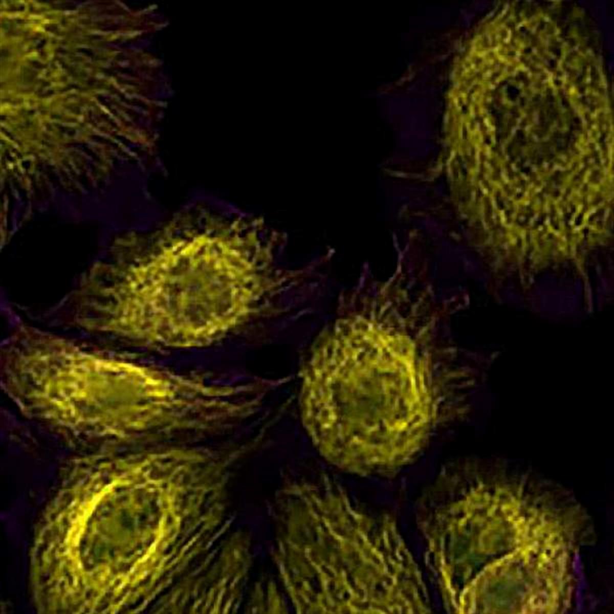 /Content/Upload/Product/TAMRAThiol_diagnocine_1200.jpg