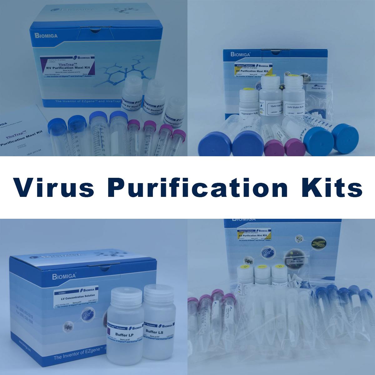 /Content/Upload/Product/Virus_Purification_Kits_Diagnocine_1200.jpg