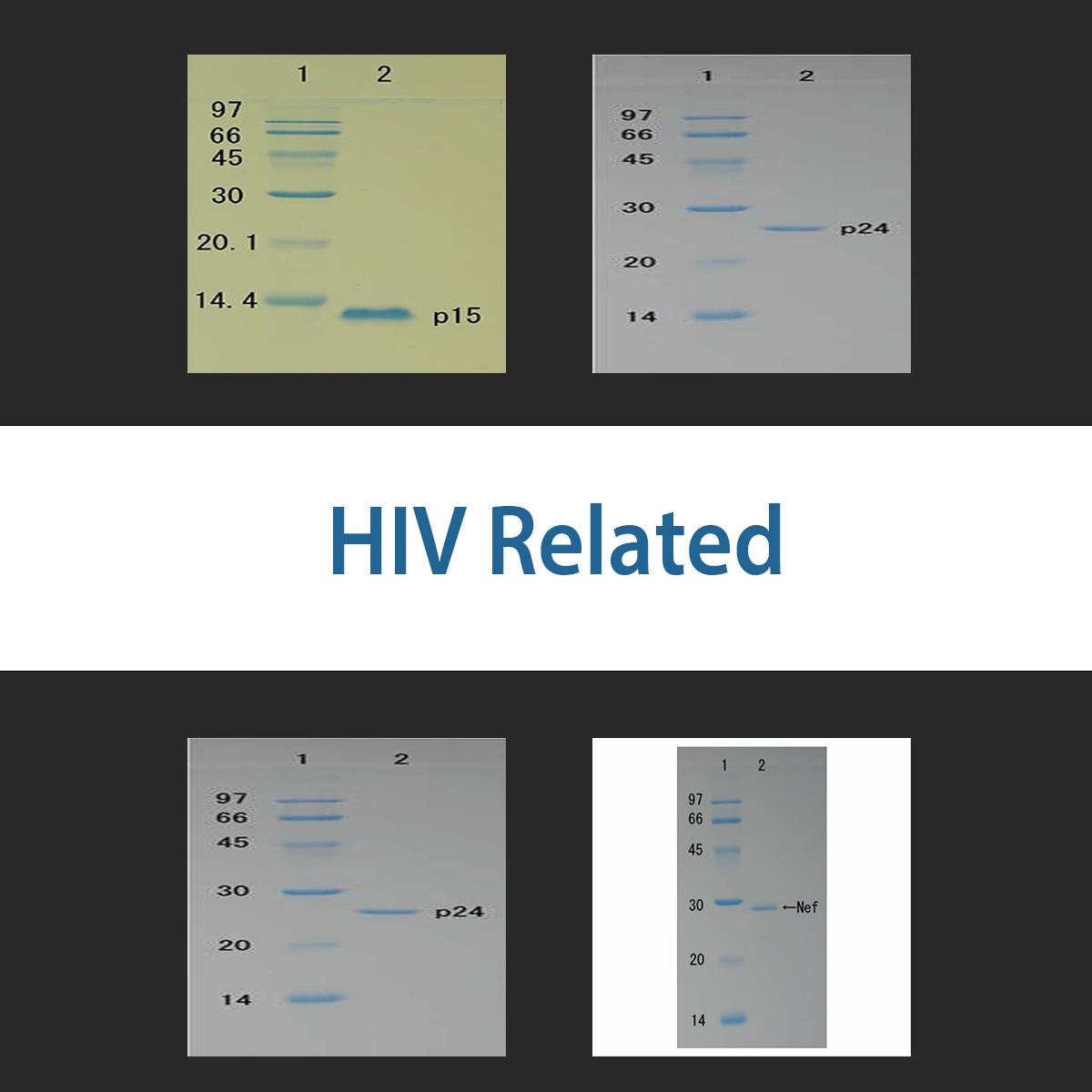 /Content/Upload/Product/hivrelated_1200_1.jpg